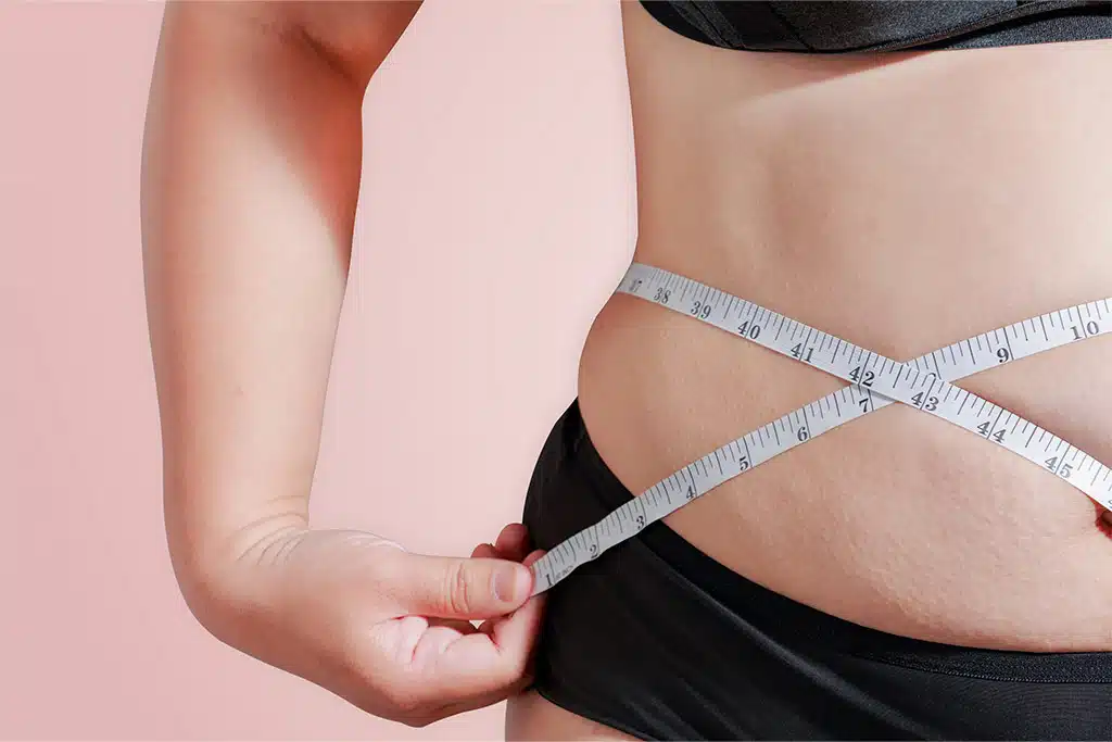 Liposucción, tratamiento quirúrgico para extraer la grasa.