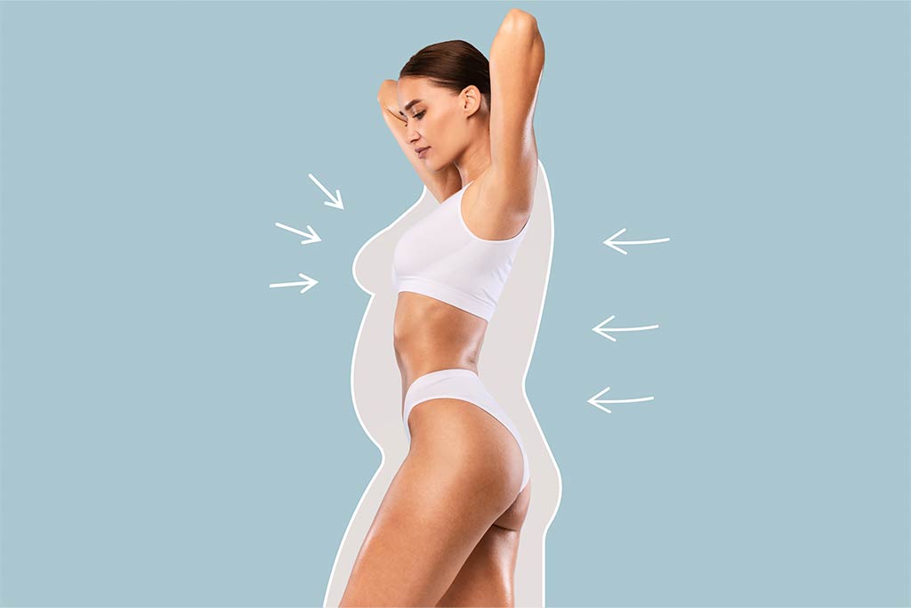 Qué es y cómo se realiza una liposucción
