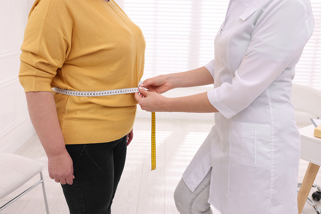 Paciente con obesidad en la consulta del doctor en Clínica Londres