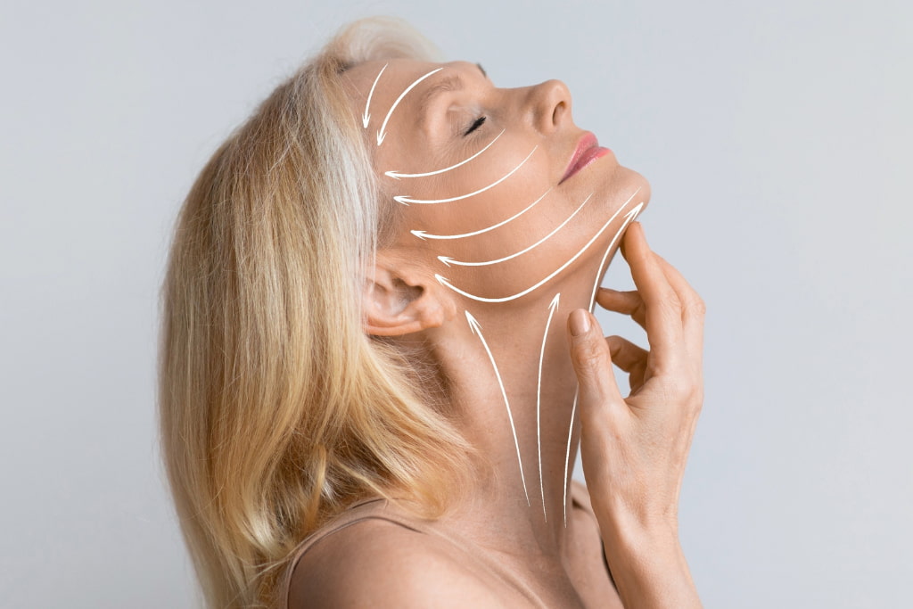 mujer minilifting facial